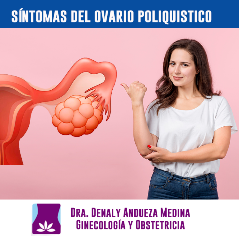 Síndrome del ovario poliquístico