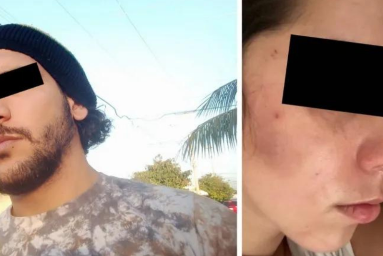 Joven yucateca denuncia a su exnovio por intentar asfixiarla en Playa del Carmen